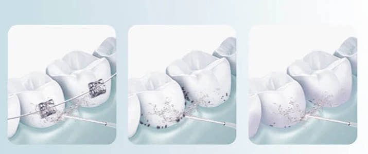 WaterFloss Pro - Tar bort smutsen som tandborsten inte får bort